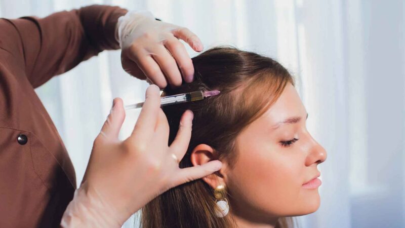 PRP for Hair Loss: A Comprehensive Overview