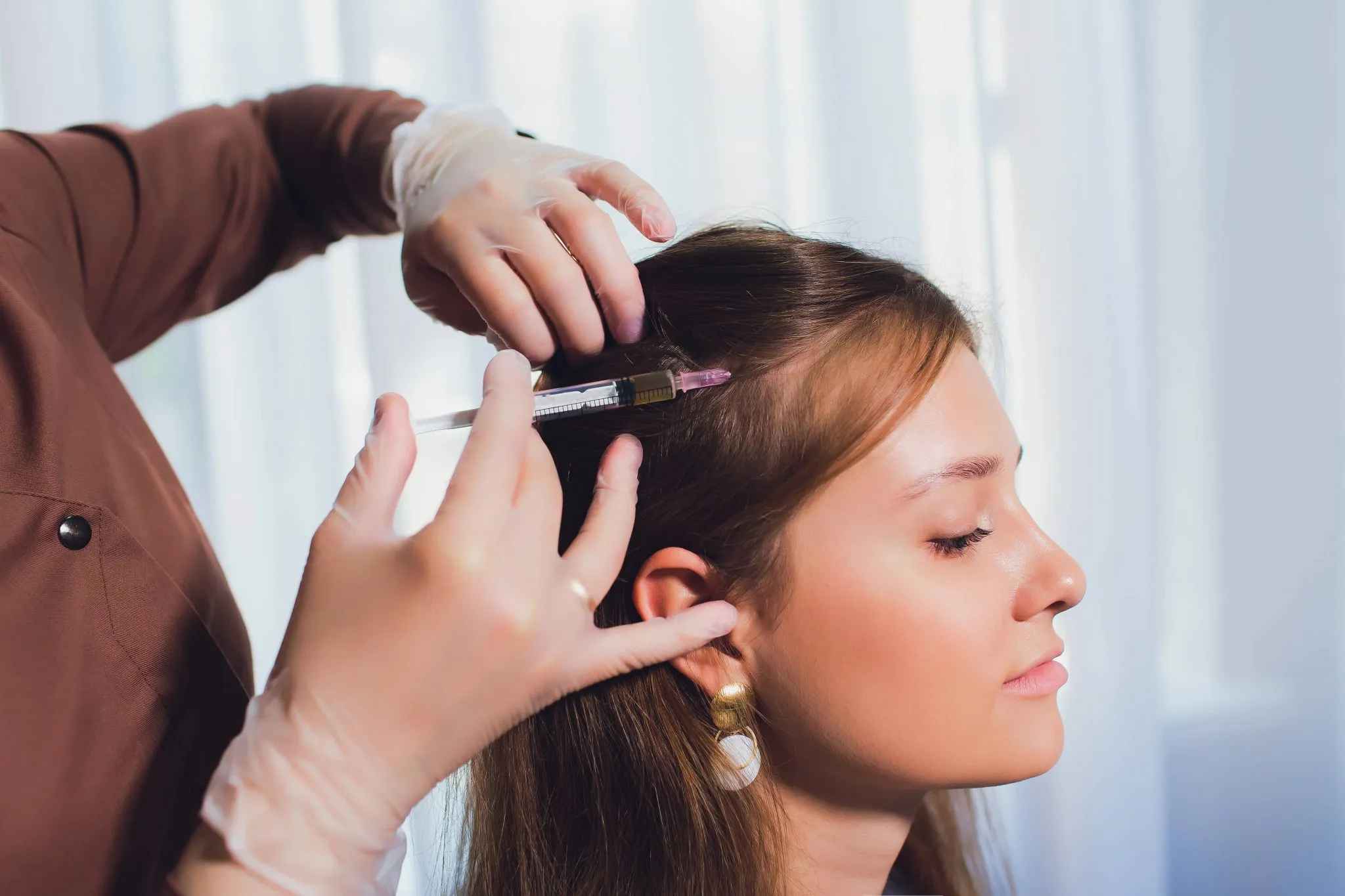 PRP for Hair Loss: A Comprehensive Overview